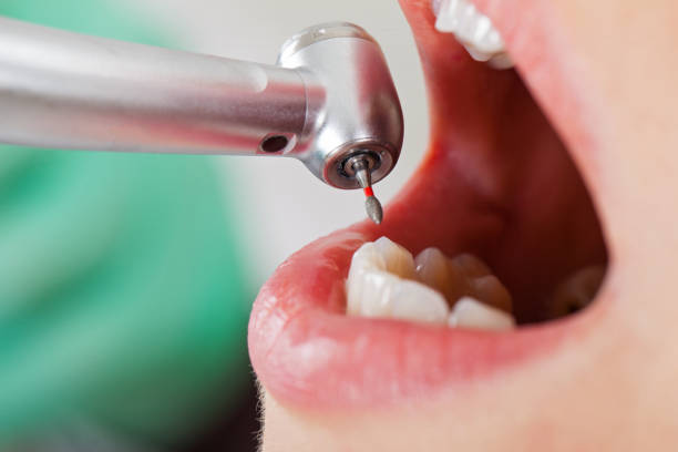 Best Emergency Denture Repair in University Park, MD